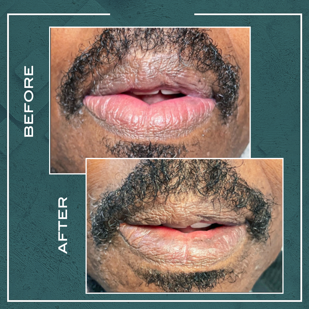 after effects imporeiting c lips black Dark Lip Neutralization Color:2S 6500mah 65C EC5